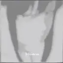 Çıkartma